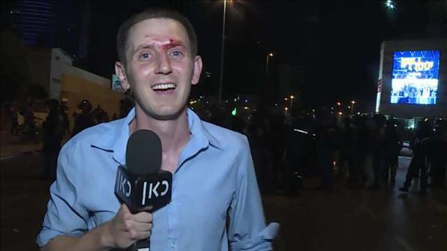 ינובסקי פצוע