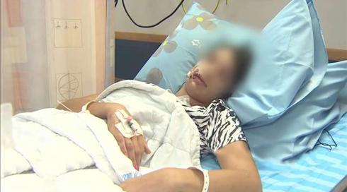 "צרחתי לאנשים שיעזרו לו": בני הנוער שנפצעו בקטטה בבריכה משחזרים