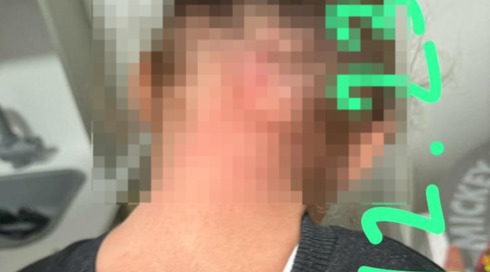 חניקה, הטחה והשפלות: חשד להתעללות בגן בירוחם