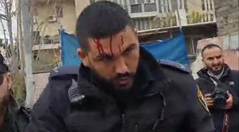 שוטר נחבל בראשו מכיסא שהושלך לעברו בשייח' ג'ראח