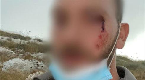 הנהגת יצהר מתנערת מתוקפי לוחמי מג"ב במאחז קומי אורי