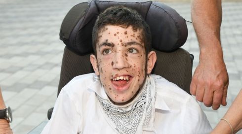 אחרי שריגש מדינה שלמה: "הילד עם הנקודות" מגיע לתיאטרון