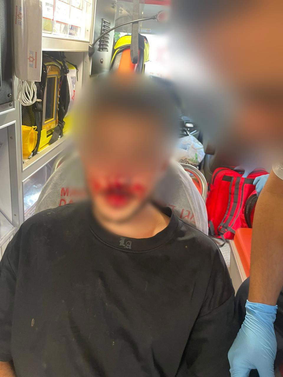 החבלות בפניו של הצעיר שהותקף לפני הדרבי התל אביבי