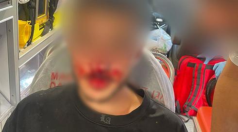 לפני הדרבי התל אביבי: 3 נעצרו בחשד שתקפו צעיר