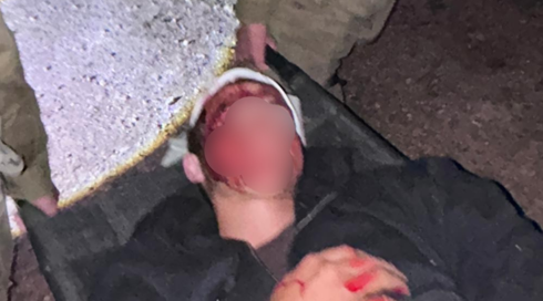 הרוג פלסטיני ויהודי פצוע קשה בעימות אלים ביהודה ושומרון