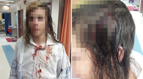 ארגון חוננו: שוטר הכה ילד בן 14 - דורשים חקירת מח"ש