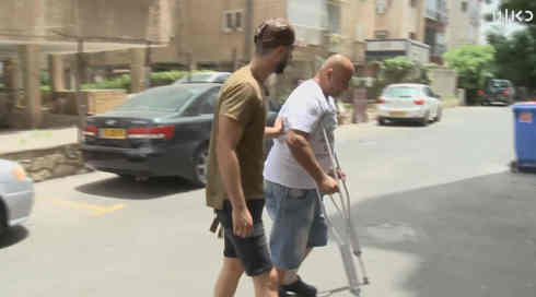 בגלל חניה: "השוטרים שברו לי את הרגל"