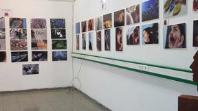 Photo therapy العلاج بالصورة
