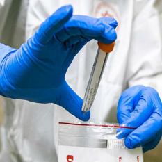 15 Preguntas y respuestas  sobre coronavirus y la
