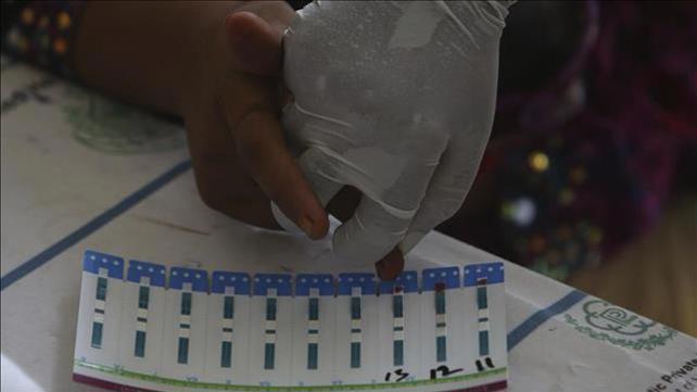 איידס, HIV, וירוס, נגיף