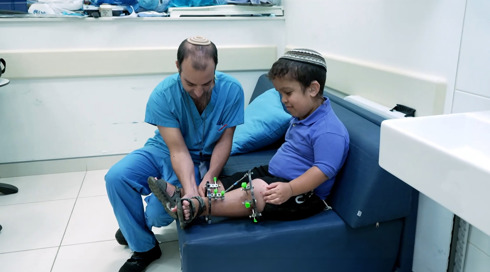 מכוונים גבוה: הישראלים שעשו ניתוח להארכת רגליים - למרות הסיכונים