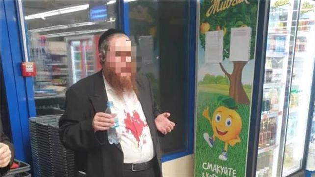 חסיד ברסלב הותקף באומן 1.09.20