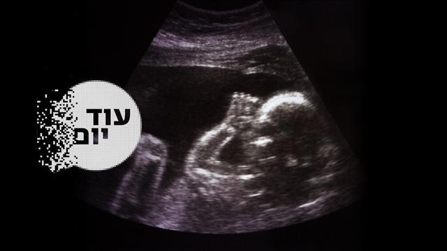 הסכת - עוד יום - הפריה