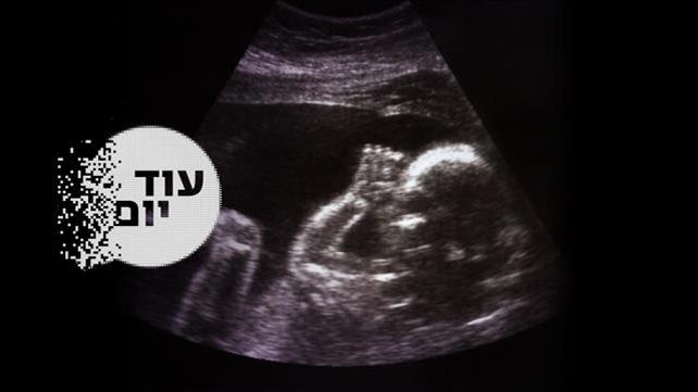 הסכת - עוד יום - הפריה