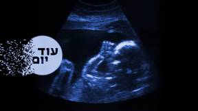 עובר (אילוסטרציה)