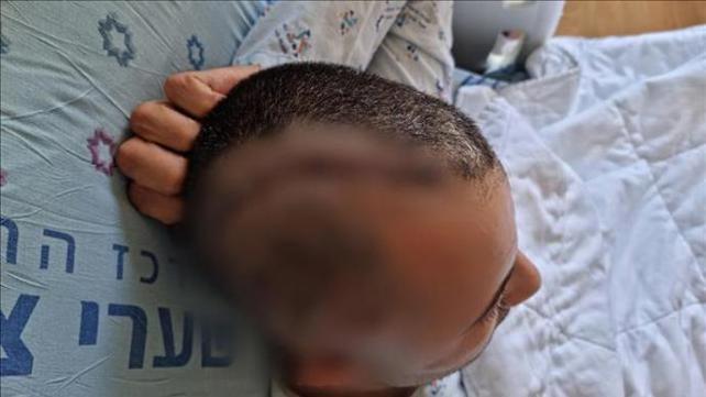 תקיפת הערבי בשייח ג'ראח