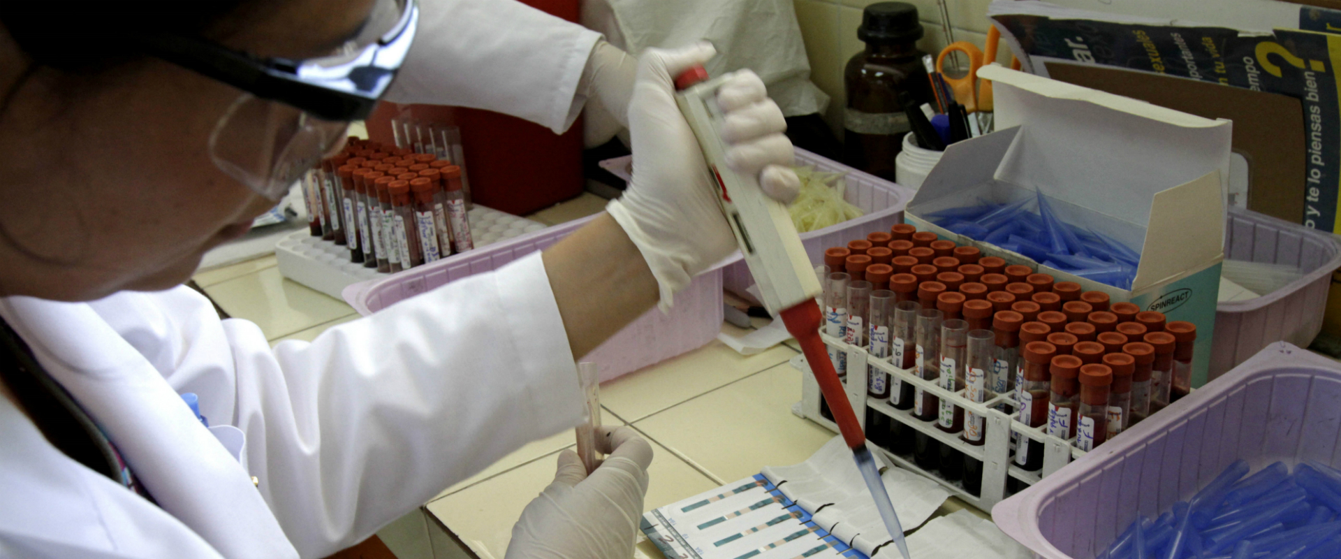 בדיקות HIV במעבדה