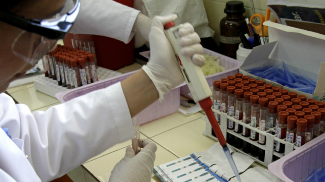 בדיקות HIV במעבדה