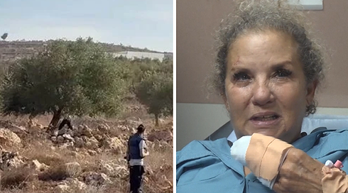 הצלמת שהותקפה
