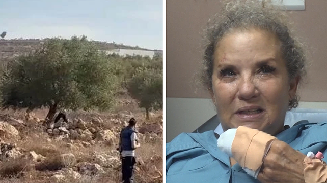הצלמת שהותקפה
