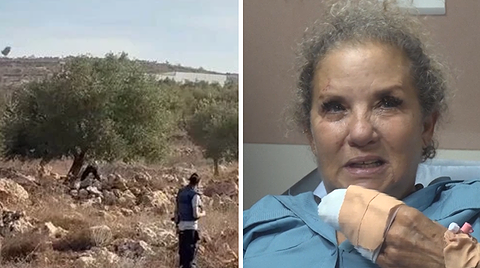 הצלמת שהותקפה