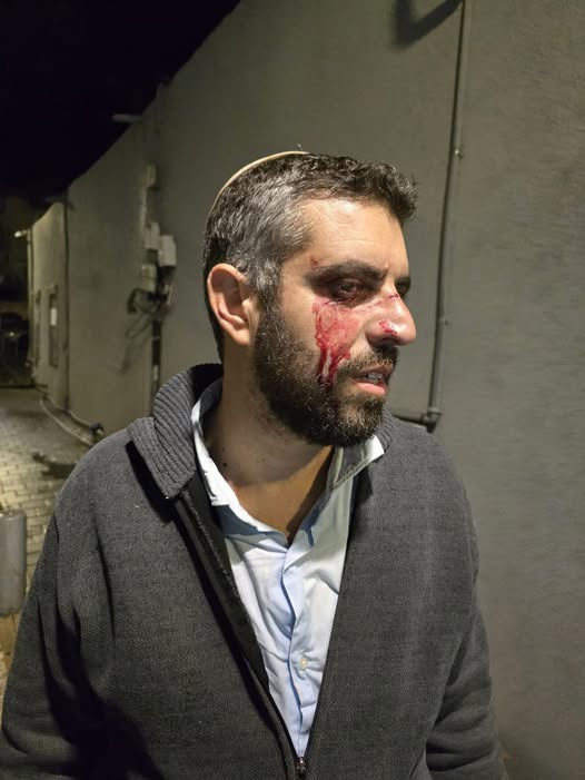 רב מישיבת ההסדר ביפו שהותקף