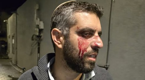 רב מישיבת ההסדר ביפו הותקף ברחוב, מצבו קל