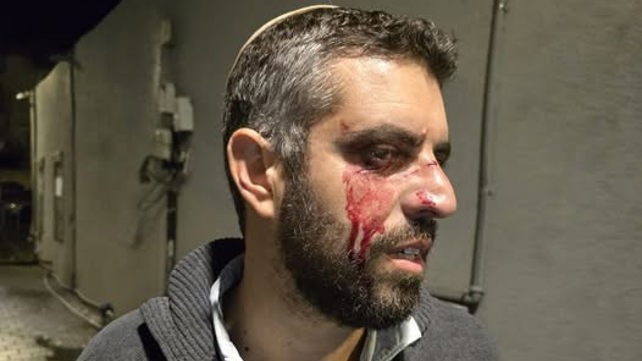 רב מישיבת ההסדר ביפו שהותקף