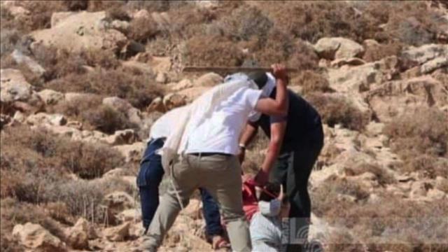 בת ה-70 שהותקפה בידי יהודים