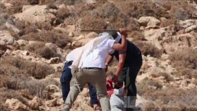 בת ה-70 שהותקפה בידי יהודים