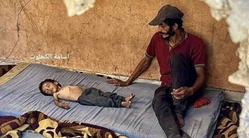 הילד שיהפוך ל"סמל הרעב" החדש? ישראל מזהירה: "חלק מהעולם קונה את זה"