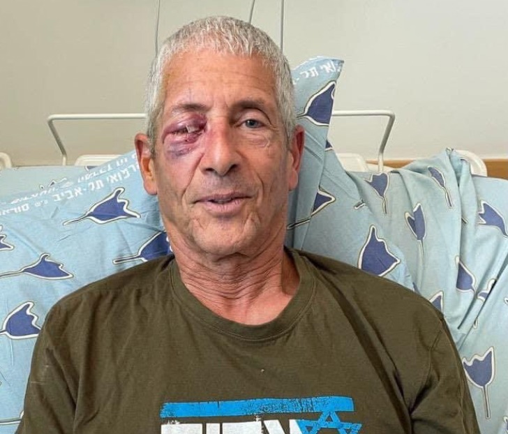 אודי אורי שנפצע באיילון