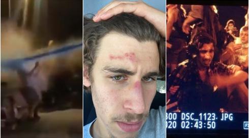 "התעלפתי, התעוררתי וברחתי": המפגין שנפגע מסילון מים בהפגנה משחזר
