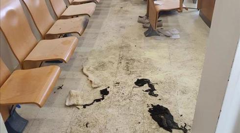 בן 71 הצית את עצמו בבית משפט בב"ש - מצבו קשה