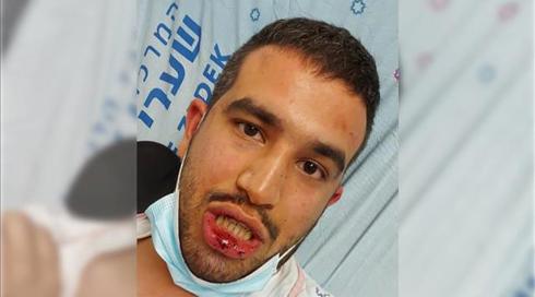 אח הכלה שחתונתה פוזרה: שוטר פשוט נתן לי אגרוף; שוטרת שהגיעה לזירה: היה פוגרום בתוך הבית