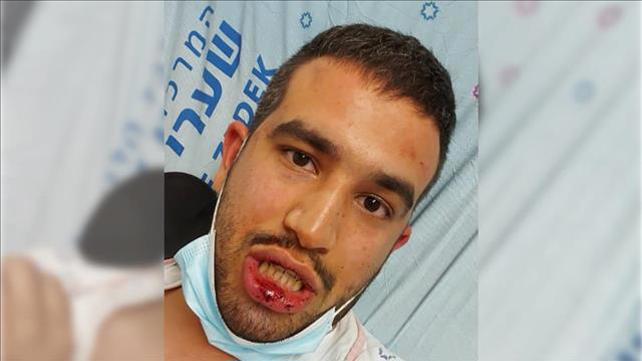 יצחק פולק, אחיה של הכלה שחתונתה פונתה בגבעת זאב, 14.10.20