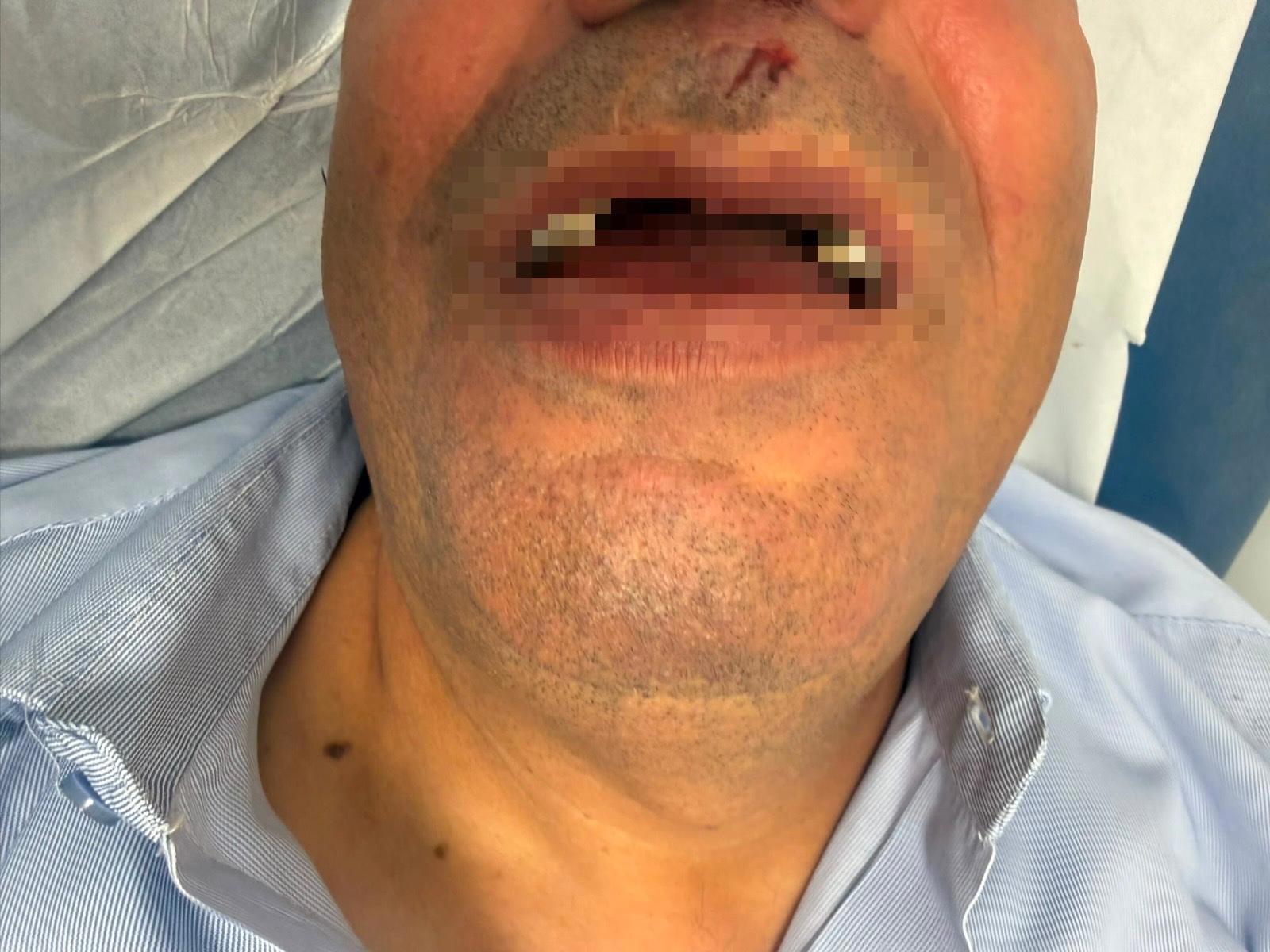 נהג האוטובוס מואת'אסם קאק שהותקף בירושלים