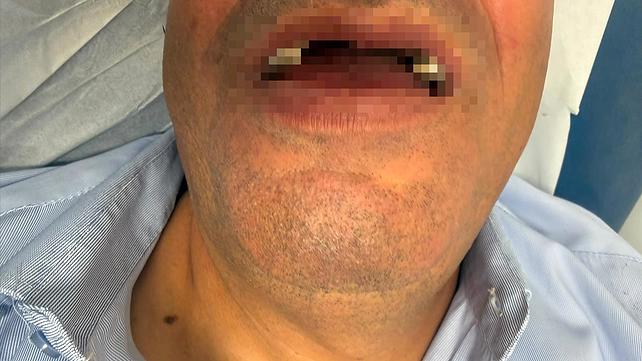 נהג האוטובוס מואת'אסם קאק שהותקף בירושלים
