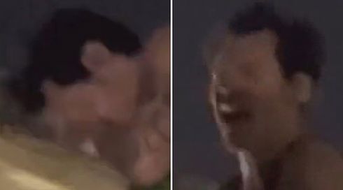 זה לא נגמר: הארי סטיילס נפגע בהופעה מחפץ שהושלך לעברו