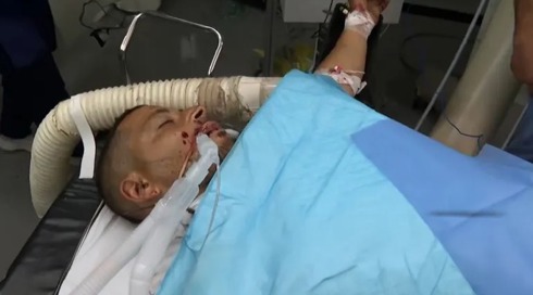 עיתונאי שמחזיק תפקיד בחמאס מקבל טיפול רפואי בקטר לאחר שנפצע בתקיפה ישראלית