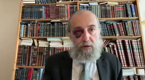 הרב שהותקף בפריז - פעמיים באותו השבוע | ריאיון מיוחד
