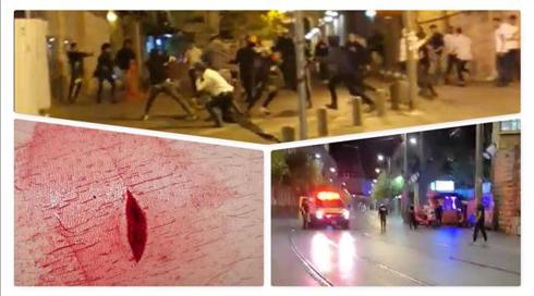 העימותים בירושלים: צעיר נפצע קל מדקירה בקטטה בכיכר ספרא, כתב כאן חדשות הותקף
