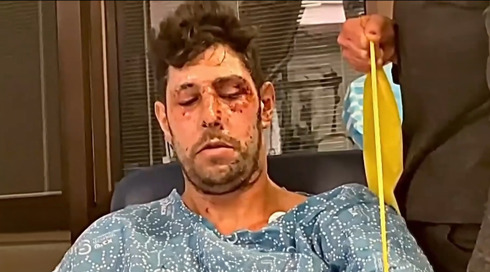 התיעוד החדש ומעורר ההשראה של עידן עמדי - כשנה אחרי שנפצע בעזה