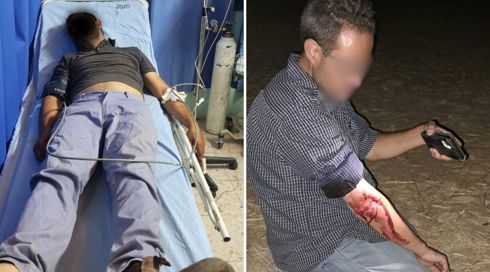 תקריות אלימות בבקעת הירדן: שני צעירים ושני פלסטינים נפצעו קל