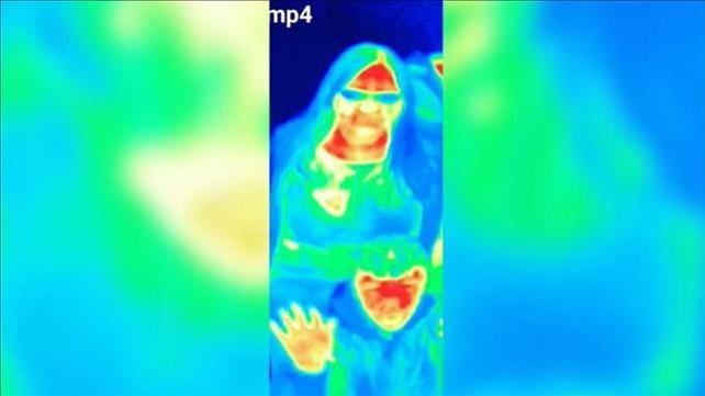 התמונה התרמית מהמצלמות באטרקציה התיירותית בסקוטלנד המראות נקודת חום מעל השד, שהובילה לאבחון סרטן השד