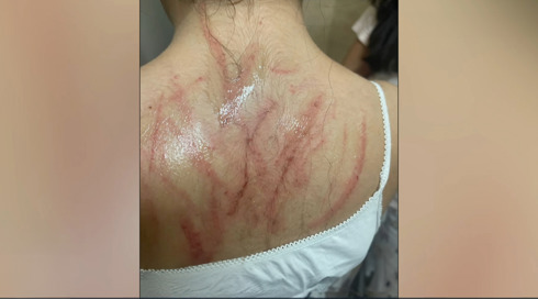 אמה של הילדה שתקפה את בת כיתתה מגיבה: "ילד מהשכבה השפיע עליה"