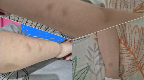 בת שש הוכתה קשות בידי בני כיתתה: "היא בטראומה"