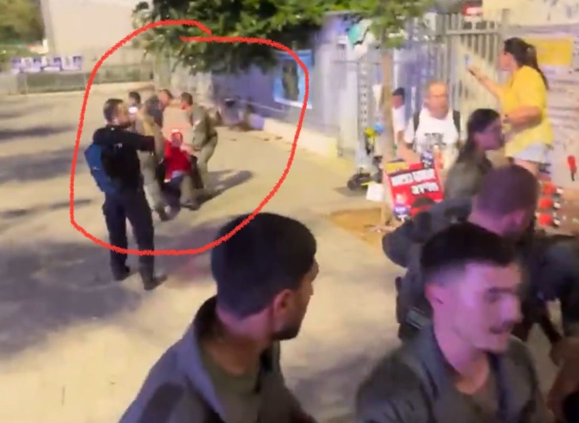 הרופא שטיפל בפצועה והוכה בהפגנה בת"א
