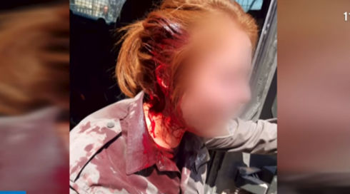 תקיפת לוחמת מג"ב ביצהר: החשוד האחרון שוחרר למעצר בית