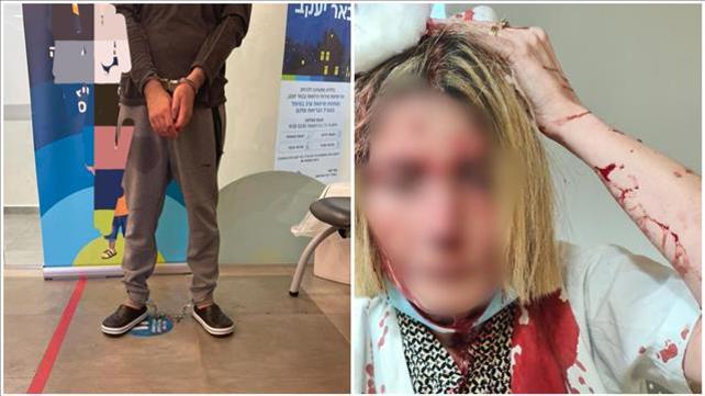 תקיפה, רופאה, קופת חולים, באר יעקב, יעקב חבה, 14.6.22